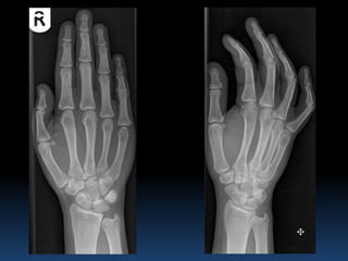 Radiographic MSK Anatomy | PPTX