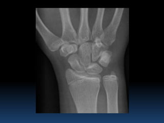 Radiographic MSK Anatomy | PPTX