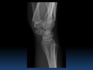 Radiographic MSK Anatomy | PPTX