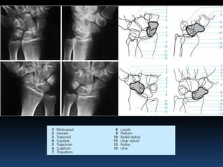 Radiographic MSK Anatomy | PPTX