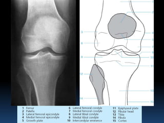 Radiographic MSK Anatomy | PPTX