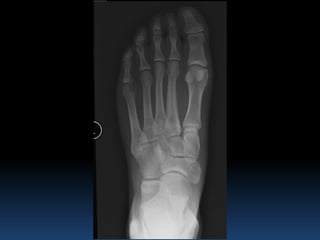 Radiographic MSK Anatomy | PPTX