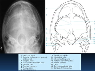 Radiographic MSK Anatomy | PPTX