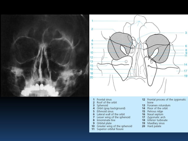 Radiographic MSK Anatomy | PPTX | Death, Injury, or Military Conflict ...