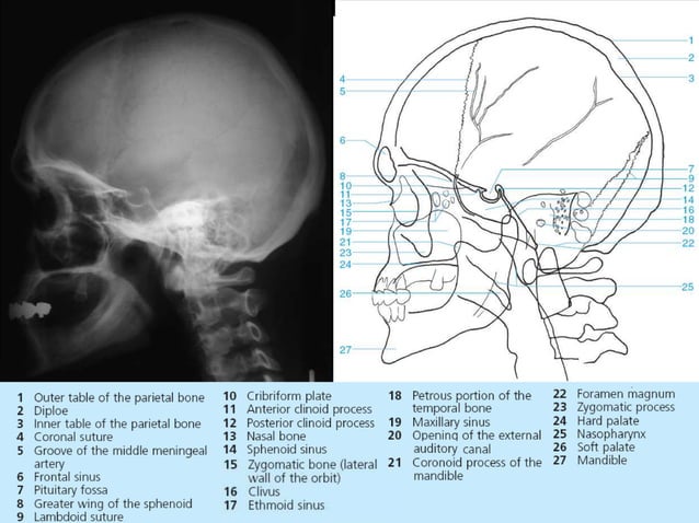 Radiographic MSK Anatomy