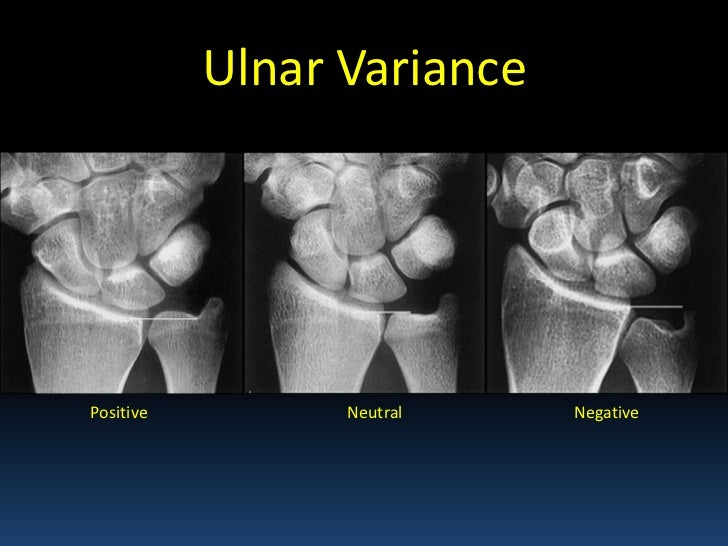 Radiographic msk anatomy