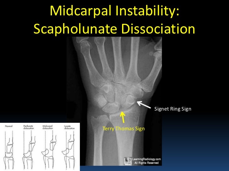 Radiographic MSK Anatomy