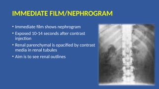 IMMEDIATE FILM/NEPHROGRAM
• Immediate film shows nephrogram
• Exposed 10-14 seconds after contrast
injection
• Renal parenchymal is opacified by contrast
media in renal tubules
• Aim is to see renal outlines
 
