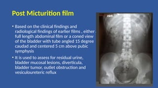 Post Micturition film
• Based on the clinical findings and
radiological findings of earlier films , either a
full length abdominal film or a coned view
of the bladder with tube angled 15 degree
caudad and centered 5 cm above pubic
symphysis
• It is used to assess for residual urine,
bladder mucosal lesions, diverticula,
bladder tumor, outlet obstruction and
vesiculoureteric reflux
 