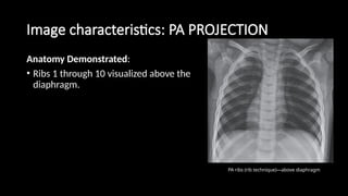Radiographic Procedures for Bony thorax and Sternum.pptx