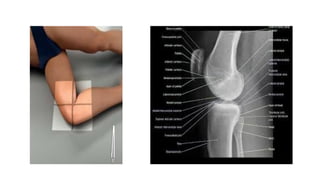 Radiographic projection (Lower limb).pptx