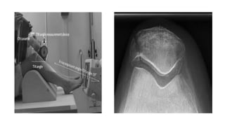Radiographic projection (Lower limb).pptx