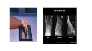 Radiographic projection (Lower limb).pptx