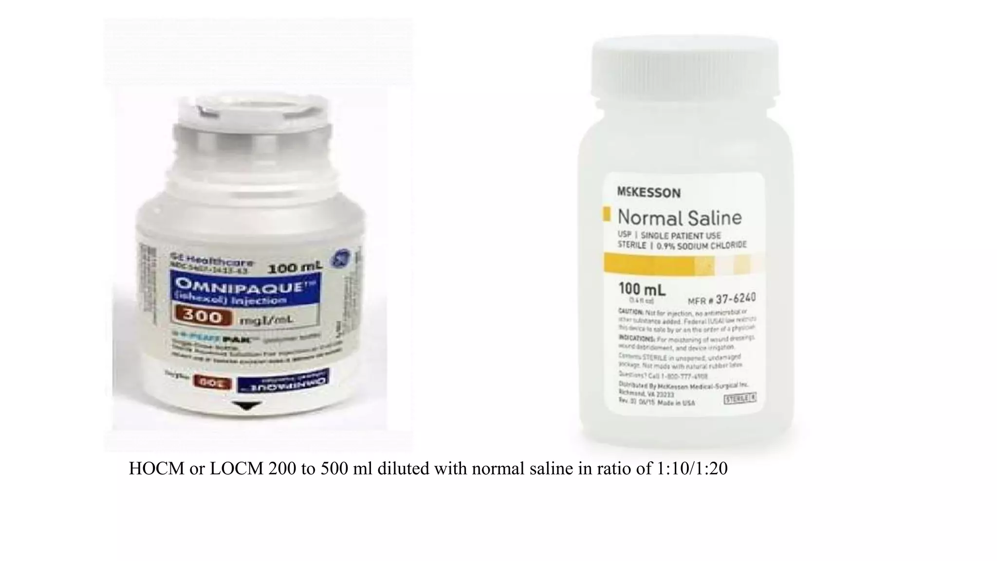 Contrast Media
HOCM or LOCM 200 to 500 ml diluted with normal saline in ratio of 1:10/1:20
 