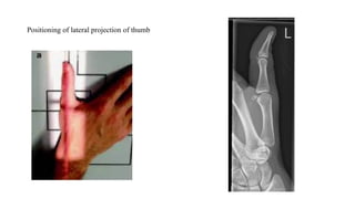 RADIOGRAPHIC TECHNIQUE USED IN X-RAYS.pptx