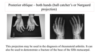 RADIOGRAPHIC TECHNIQUE USED IN X-RAYS.pptx