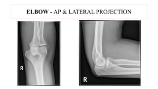 RADIOGRAPHIC TECHNIQUE USED IN X-RAYS.pptx