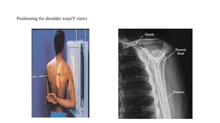 Axillary Radiograph Position RADIOGRAPHIC TECHNIQUE USED IN X-RAYS.pptx