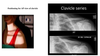 RADIOGRAPHIC TECHNIQUE USED IN X-RAYS.pptx
