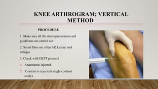 RADIOGRAPHIC TECHNIQUE ARTHROGRAPHY.pptx