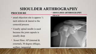 RADIOGRAPHIC TECHNIQUE ARTHROGRAPHY.pptx