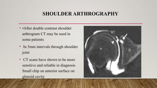 RADIOGRAPHIC TECHNIQUE ARTHROGRAPHY.pptx