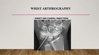 Wrist Injection Radiology RADIOGRAPHIC TECHNIQUE ARTHROGRAPHY.pptx