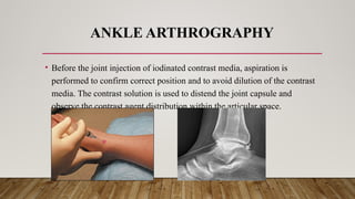 RADIOGRAPHIC TECHNIQUE ARTHROGRAPHY.pptx