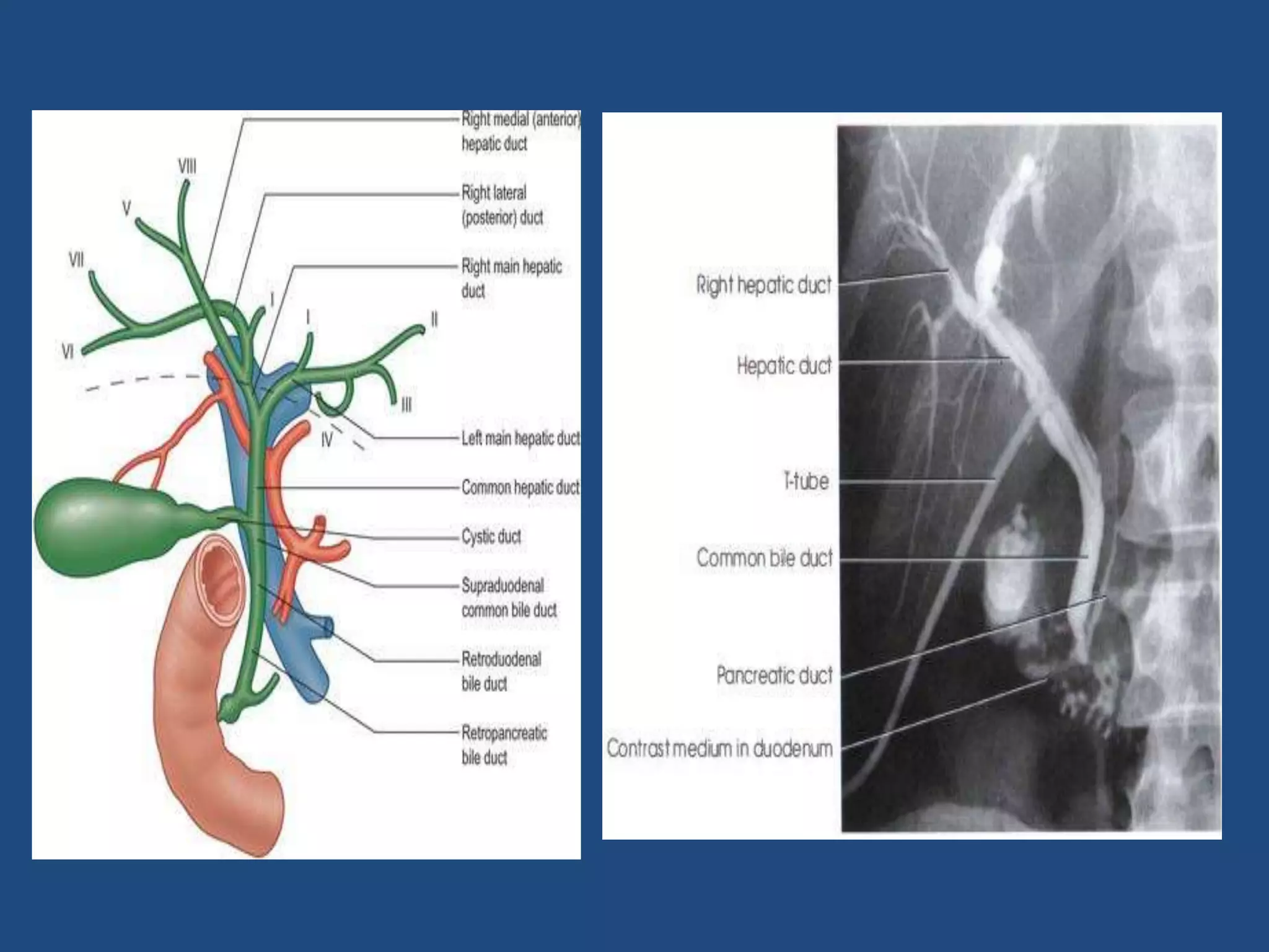 Radiographic technique of biliary system | PPTX