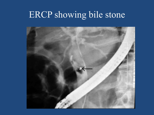 Radiographic technique of biliary system | PPTX | Digestive Disorders ...