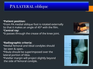 Radiographic technique of Leg, Knee, Femur V2.pptx