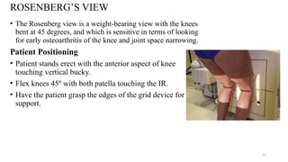 Normal Rosenberg. View RADIOGRAPHIC TECHNIQUE OF LEG, KNEE JOINT AND FEMUR.pptx
