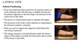 RADIOGRAPHIC TECHNIQUE OF LEG, KNEE JOINT AND FEMUR.pptx