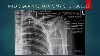 RADIOGRAPHIC TECHNIQUE OF SHOULDER(1).pptx