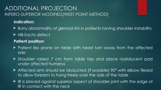 RADIOGRAPHIC TECHNIQUE OF SHOULDER(1).pptx