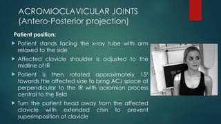 RADIOGRAPHIC TECHNIQUE OF SHOULDER(1).pptx