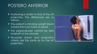 RADIOGRAPHIC TECHNIQUE OF SHOULDER(1).pptx