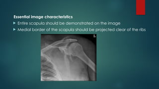 RADIOGRAPHIC TECHNIQUE OF SHOULDER(1).pptx