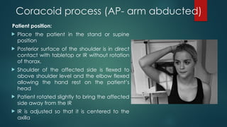 RADIOGRAPHIC TECHNIQUE OF SHOULDER(1).pptx