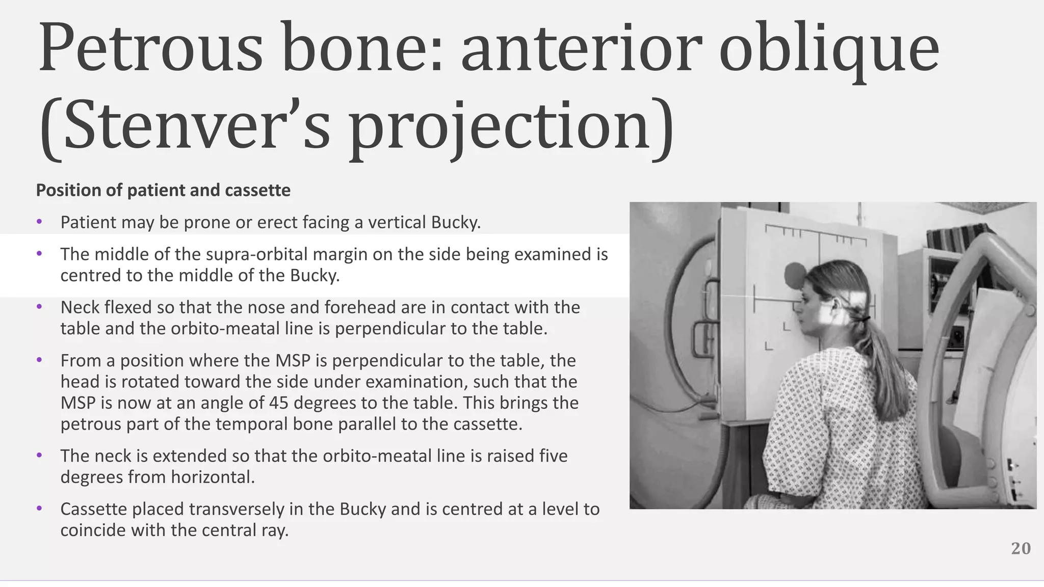 Petrous bone: anterior oblique
(Stenver’s projection)
Position of patient and cassette
• Patient may be prone or erect facing a vertical Bucky.
• The middle of the supra-orbital margin on the side being examined is
centred to the middle of the Bucky.
• Neck flexed so that the nose and forehead are in contact with the
table and the orbito-meatal line is perpendicular to the table.
• From a position where the MSP is perpendicular to the table, the
head is rotated toward the side under examination, such that the
MSP is now at an angle of 45 degrees to the table. This brings the
petrous part of the temporal bone parallel to the cassette.
• The neck is extended so that the orbito-meatal line is raised five
degrees from horizontal.
• Cassette placed transversely in the Bucky and is centred at a level to
coincide with the central ray.
20
 