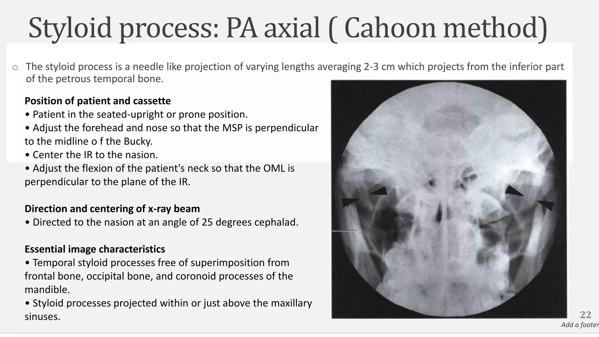 Styloid process: PA axial ( Cahoon method)
o The styloid process is a needle like projection of varying lengths averaging 2-3 cm which projects from the inferior part
of the petrous temporal bone.
22
Add a footer
Position of patient and cassette
• Patient in the seated-upright or prone position.
• Adjust the forehead and nose so that the MSP is perpendicular
to the midline o f the Bucky.
• Center the IR to the nasion.
• Adjust the flexion of the patient's neck so that the OML is
perpendicular to the plane of the IR.
Direction and centering of x-ray beam
• Directed to the nasion at an angle of 25 degrees cephalad.
Essential image characteristics
• Temporal styloid processes free of superimposition from
frontal bone, occipital bone, and coronoid processes of the
mandible.
• Styloid processes projected within or just above the maxillary
sinuses.
 