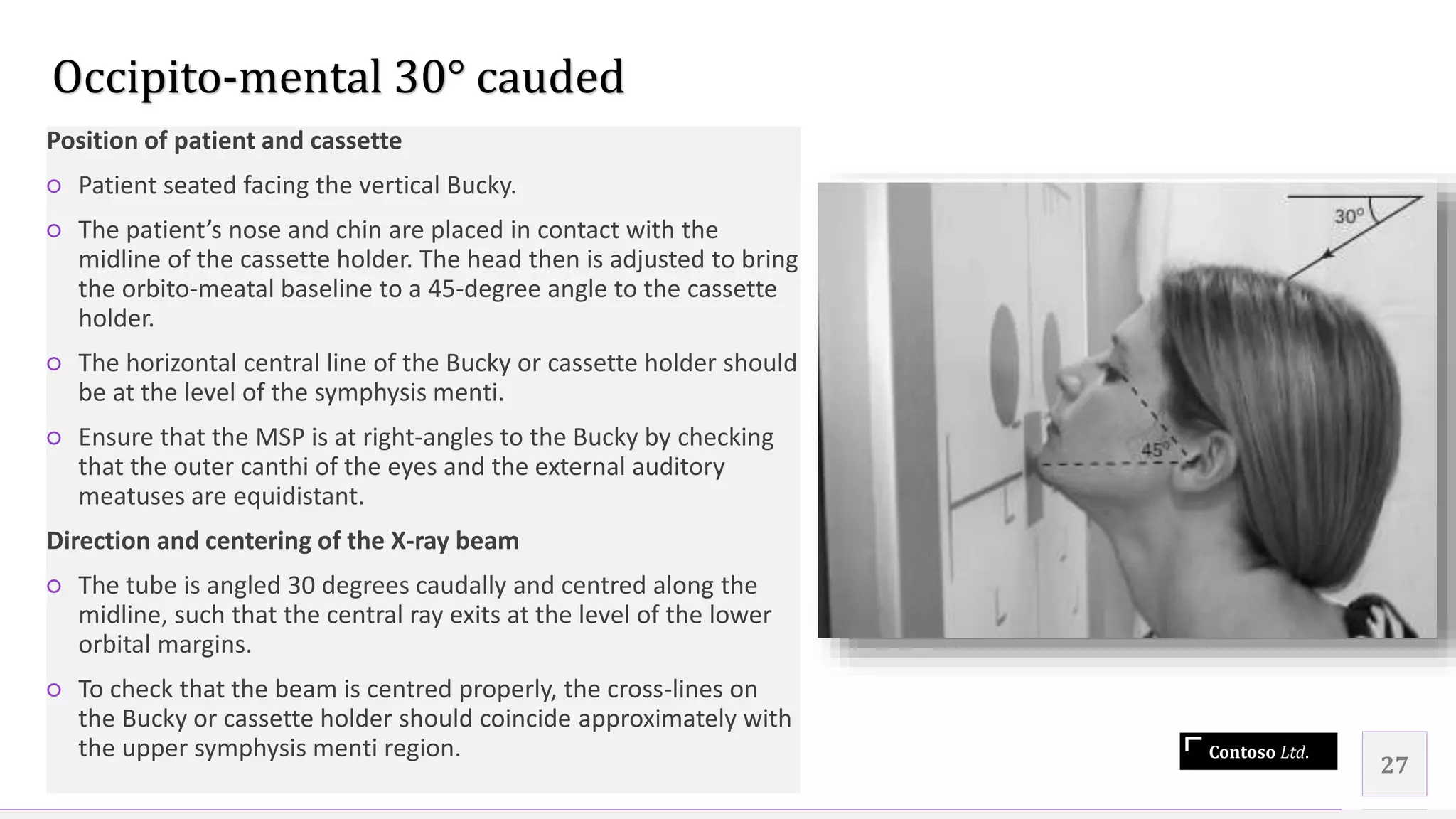 Contoso Ltd.
Position of patient and cassette
○ Patient seated facing the vertical Bucky.
○ The patient’s nose and chin are placed in contact with the
midline of the cassette holder. The head then is adjusted to bring
the orbito-meatal baseline to a 45-degree angle to the cassette
holder.
○ The horizontal central line of the Bucky or cassette holder should
be at the level of the symphysis menti.
○ Ensure that the MSP is at right-angles to the Bucky by checking
that the outer canthi of the eyes and the external auditory
meatuses are equidistant.
Direction and centering of the X-ray beam
○ The tube is angled 30 degrees caudally and centred along the
midline, such that the central ray exits at the level of the lower
orbital margins.
○ To check that the beam is centred properly, the cross-lines on
the Bucky or cassette holder should coincide approximately with
the upper symphysis menti region.
27
Occipito-mental 30° cauded
 