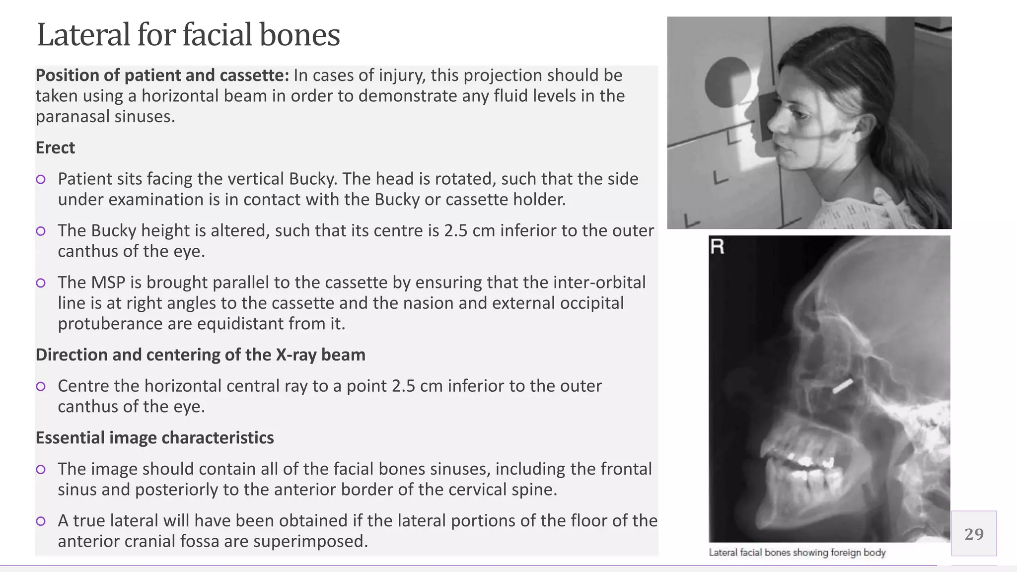 Contoso Ltd.
Position of patient and cassette: In cases of injury, this projection should be
taken using a horizontal beam in order to demonstrate any fluid levels in the
paranasal sinuses.
Erect
○ Patient sits facing the vertical Bucky. The head is rotated, such that the side
under examination is in contact with the Bucky or cassette holder.
○ The Bucky height is altered, such that its centre is 2.5 cm inferior to the outer
canthus of the eye.
○ The MSP is brought parallel to the cassette by ensuring that the inter-orbital
line is at right angles to the cassette and the nasion and external occipital
protuberance are equidistant from it.
Direction and centering of the X-ray beam
○ Centre the horizontal central ray to a point 2.5 cm inferior to the outer
canthus of the eye.
Essential image characteristics
○ The image should contain all of the facial bones sinuses, including the frontal
sinus and posteriorly to the anterior border of the cervical spine.
○ A true lateral will have been obtained if the lateral portions of the floor of the
anterior cranial fossa are superimposed. 29
Lateral for facial bones
 