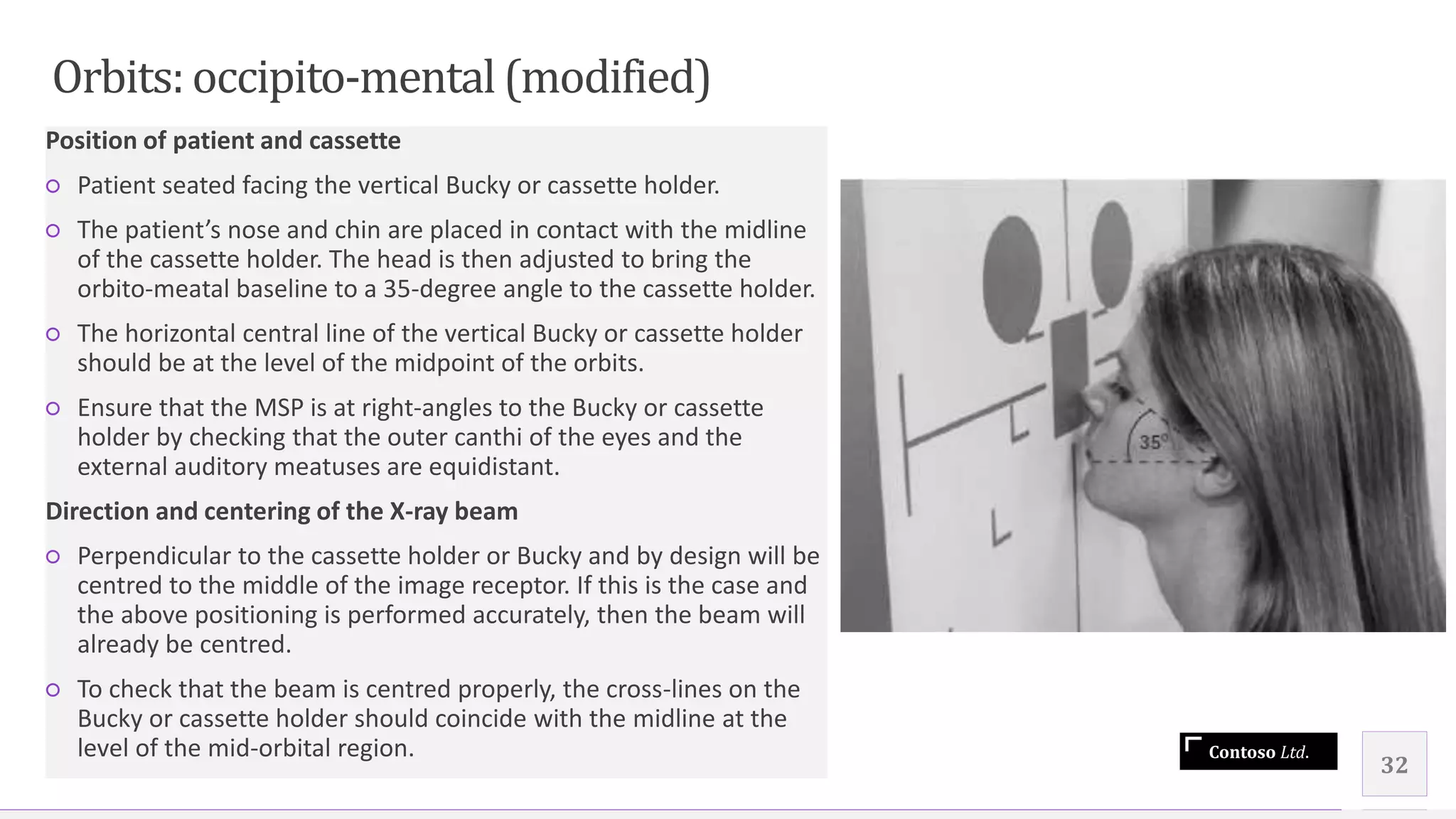 Contoso Ltd.
Position of patient and cassette
○ Patient seated facing the vertical Bucky or cassette holder.
○ The patient’s nose and chin are placed in contact with the midline
of the cassette holder. The head is then adjusted to bring the
orbito-meatal baseline to a 35-degree angle to the cassette holder.
○ The horizontal central line of the vertical Bucky or cassette holder
should be at the level of the midpoint of the orbits.
○ Ensure that the MSP is at right-angles to the Bucky or cassette
holder by checking that the outer canthi of the eyes and the
external auditory meatuses are equidistant.
Direction and centering of the X-ray beam
○ Perpendicular to the cassette holder or Bucky and by design will be
centred to the middle of the image receptor. If this is the case and
the above positioning is performed accurately, then the beam will
already be centred.
○ To check that the beam is centred properly, the cross-lines on the
Bucky or cassette holder should coincide with the midline at the
level of the mid-orbital region.
32
Orbits: occipito-mental(modified)
 