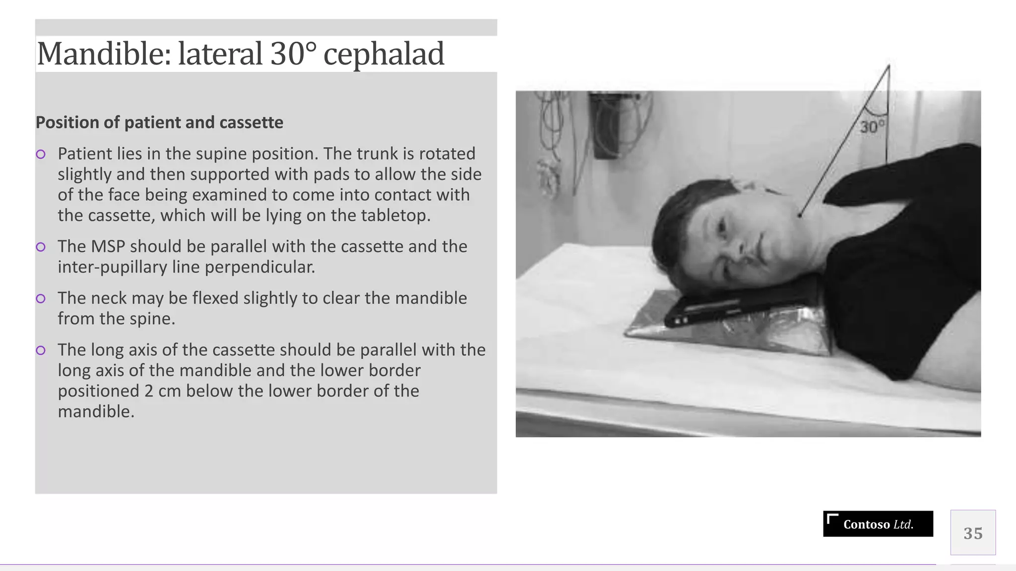 Contoso Ltd.
Position of patient and cassette
○ Patient lies in the supine position. The trunk is rotated
slightly and then supported with pads to allow the side
of the face being examined to come into contact with
the cassette, which will be lying on the tabletop.
○ The MSP should be parallel with the cassette and the
inter-pupillary line perpendicular.
○ The neck may be flexed slightly to clear the mandible
from the spine.
○ The long axis of the cassette should be parallel with the
long axis of the mandible and the lower border
positioned 2 cm below the lower border of the
mandible.
35
Mandible: lateral 30° cephalad
 