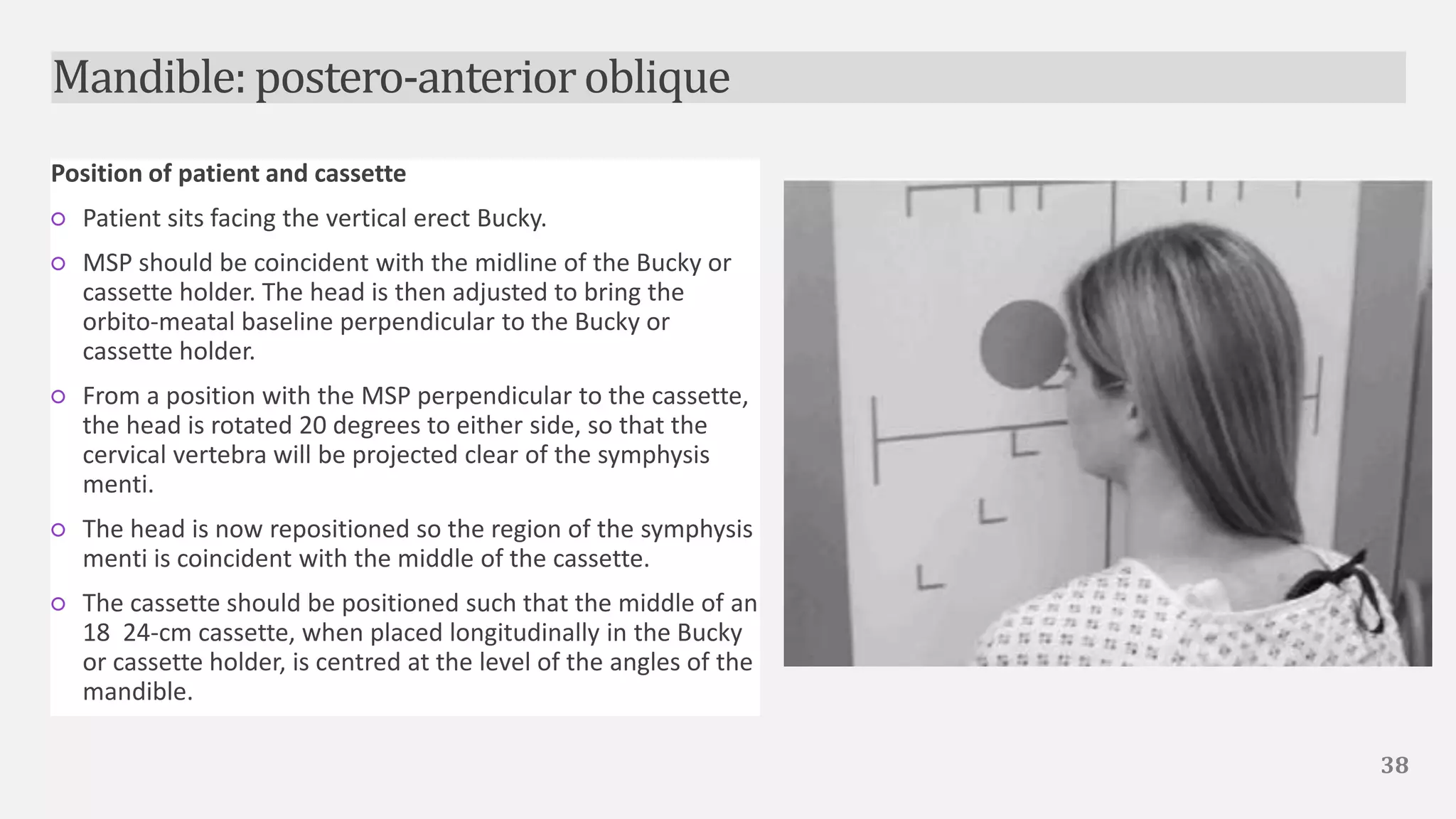 Contoso Ltd.
Position of patient and cassette
○ Patient sits facing the vertical erect Bucky.
○ MSP should be coincident with the midline of the Bucky or
cassette holder. The head is then adjusted to bring the
orbito-meatal baseline perpendicular to the Bucky or
cassette holder.
○ From a position with the MSP perpendicular to the cassette,
the head is rotated 20 degrees to either side, so that the
cervical vertebra will be projected clear of the symphysis
menti.
○ The head is now repositioned so the region of the symphysis
menti is coincident with the middle of the cassette.
○ The cassette should be positioned such that the middle of an
18 24-cm cassette, when placed longitudinally in the Bucky
or cassette holder, is centred at the level of the angles of the
mandible.
38
Mandible: postero-anterioroblique
 