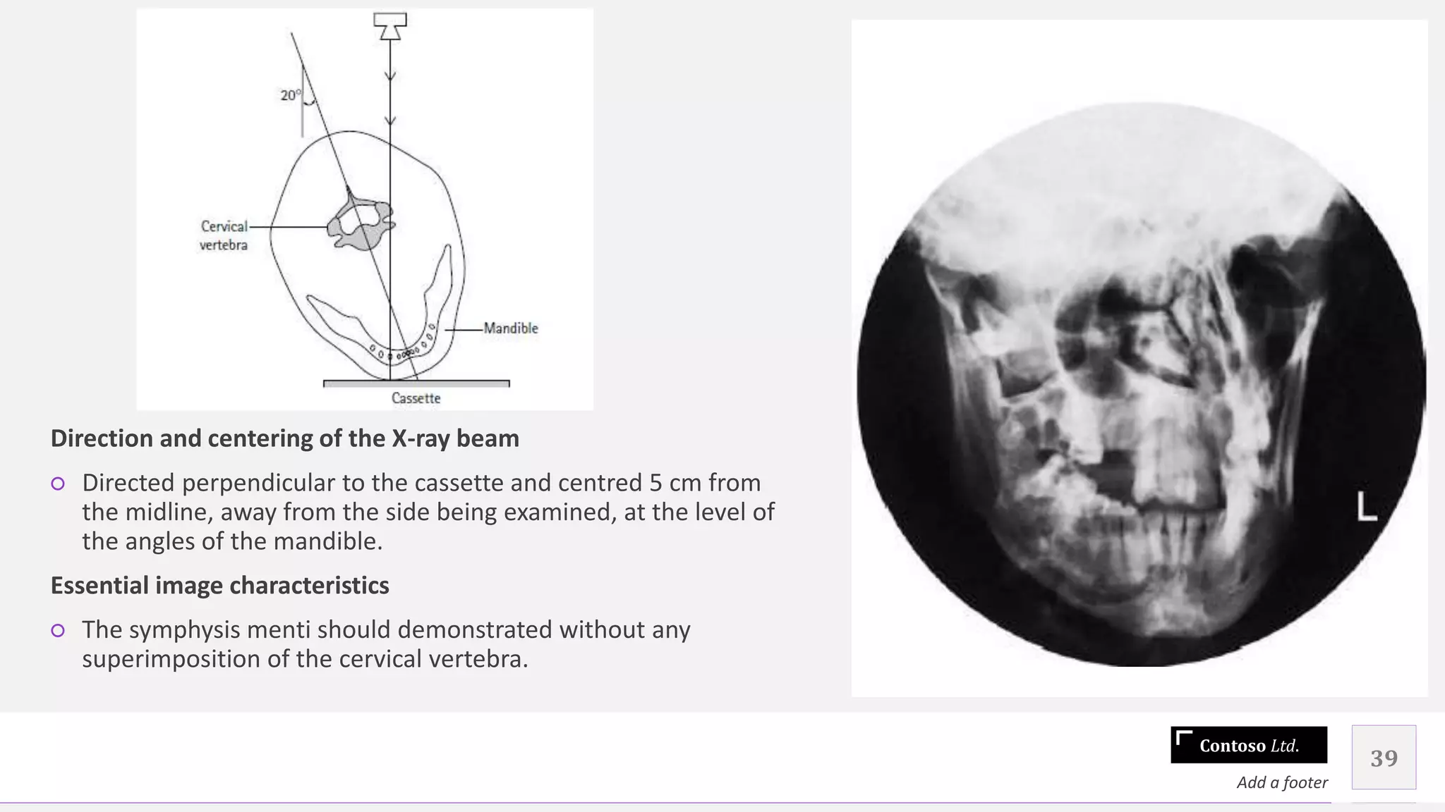 Contoso Ltd.
39
Add a footer
Direction and centering of the X-ray beam
○ Directed perpendicular to the cassette and centred 5 cm from
the midline, away from the side being examined, at the level of
the angles of the mandible.
Essential image characteristics
○ The symphysis menti should demonstrated without any
superimposition of the cervical vertebra.
 