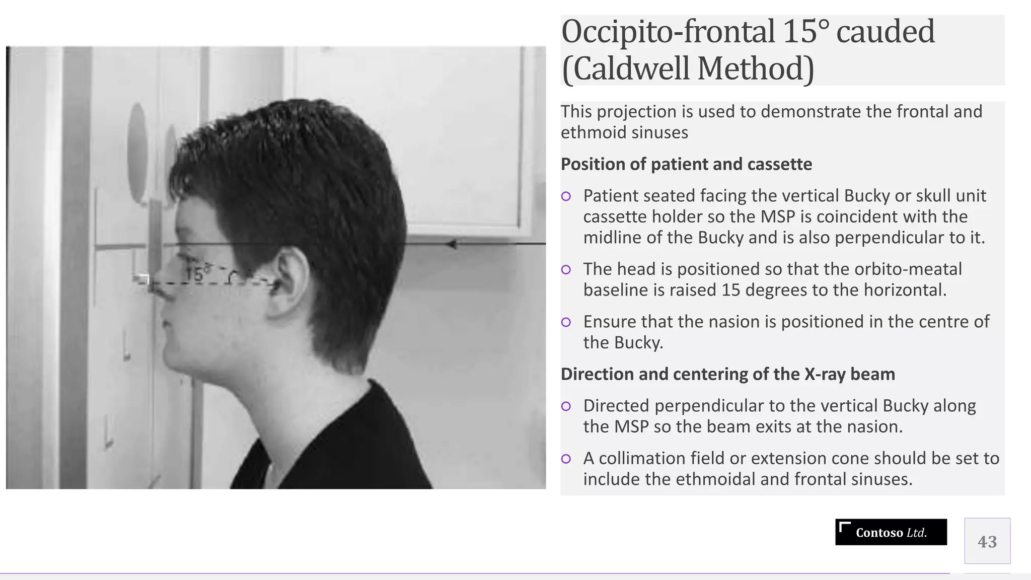 Contoso Ltd.
This projection is used to demonstrate the frontal and
ethmoid sinuses
Position of patient and cassette
○ Patient seated facing the vertical Bucky or skull unit
cassette holder so the MSP is coincident with the
midline of the Bucky and is also perpendicular to it.
○ The head is positioned so that the orbito-meatal
baseline is raised 15 degrees to the horizontal.
○ Ensure that the nasion is positioned in the centre of
the Bucky.
Direction and centering of the X-ray beam
○ Directed perpendicular to the vertical Bucky along
the MSP so the beam exits at the nasion.
○ A collimation field or extension cone should be set to
include the ethmoidal and frontal sinuses.
43
Occipito-frontal15°cauded
(Caldwell Method)
 