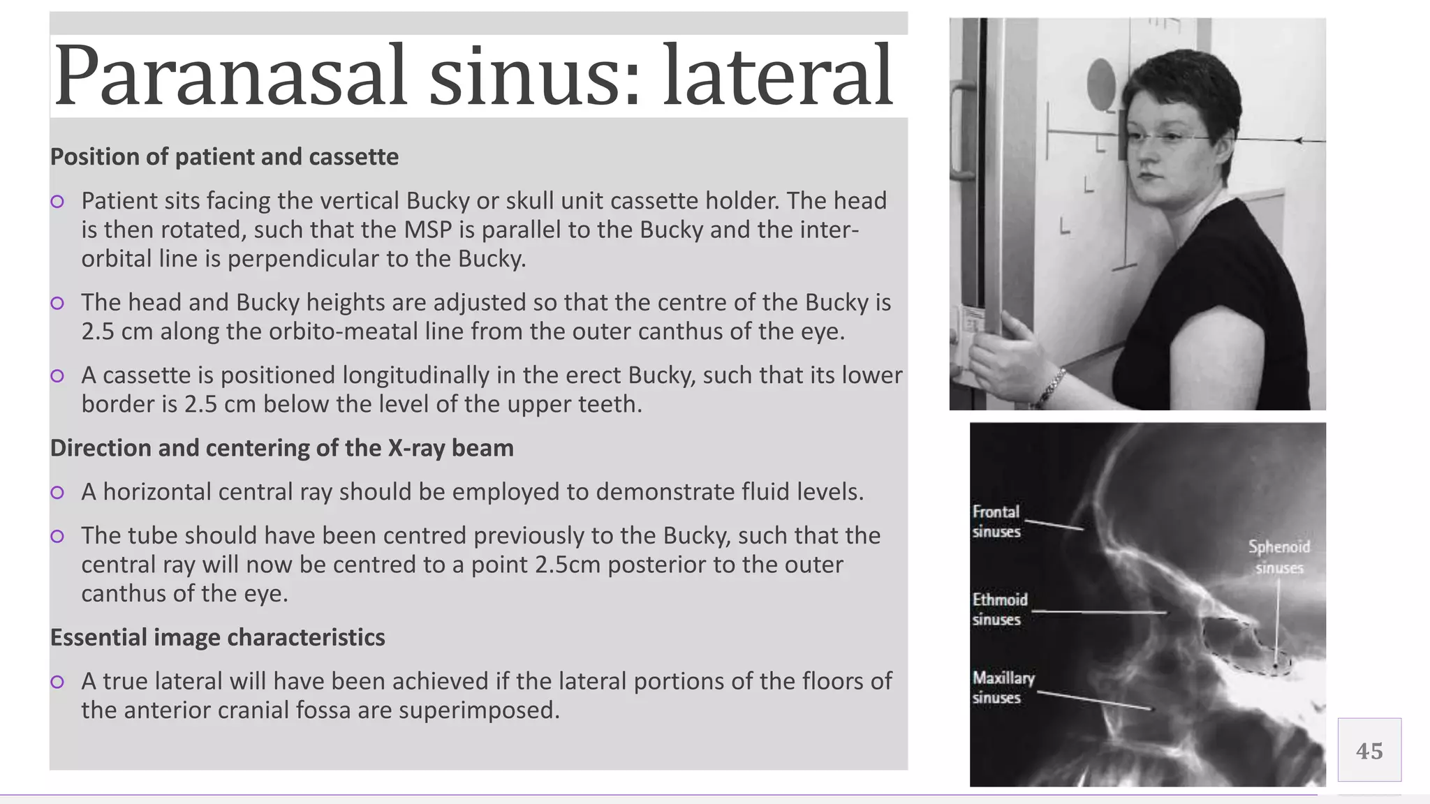 Contoso Ltd.
Position of patient and cassette
○ Patient sits facing the vertical Bucky or skull unit cassette holder. The head
is then rotated, such that the MSP is parallel to the Bucky and the inter-
orbital line is perpendicular to the Bucky.
○ The head and Bucky heights are adjusted so that the centre of the Bucky is
2.5 cm along the orbito-meatal line from the outer canthus of the eye.
○ A cassette is positioned longitudinally in the erect Bucky, such that its lower
border is 2.5 cm below the level of the upper teeth.
Direction and centering of the X-ray beam
○ A horizontal central ray should be employed to demonstrate fluid levels.
○ The tube should have been centred previously to the Bucky, such that the
central ray will now be centred to a point 2.5cm posterior to the outer
canthus of the eye.
Essential image characteristics
○ A true lateral will have been achieved if the lateral portions of the floors of
the anterior cranial fossa are superimposed.
45
Add a footer
Paranasal sinus: lateral
 