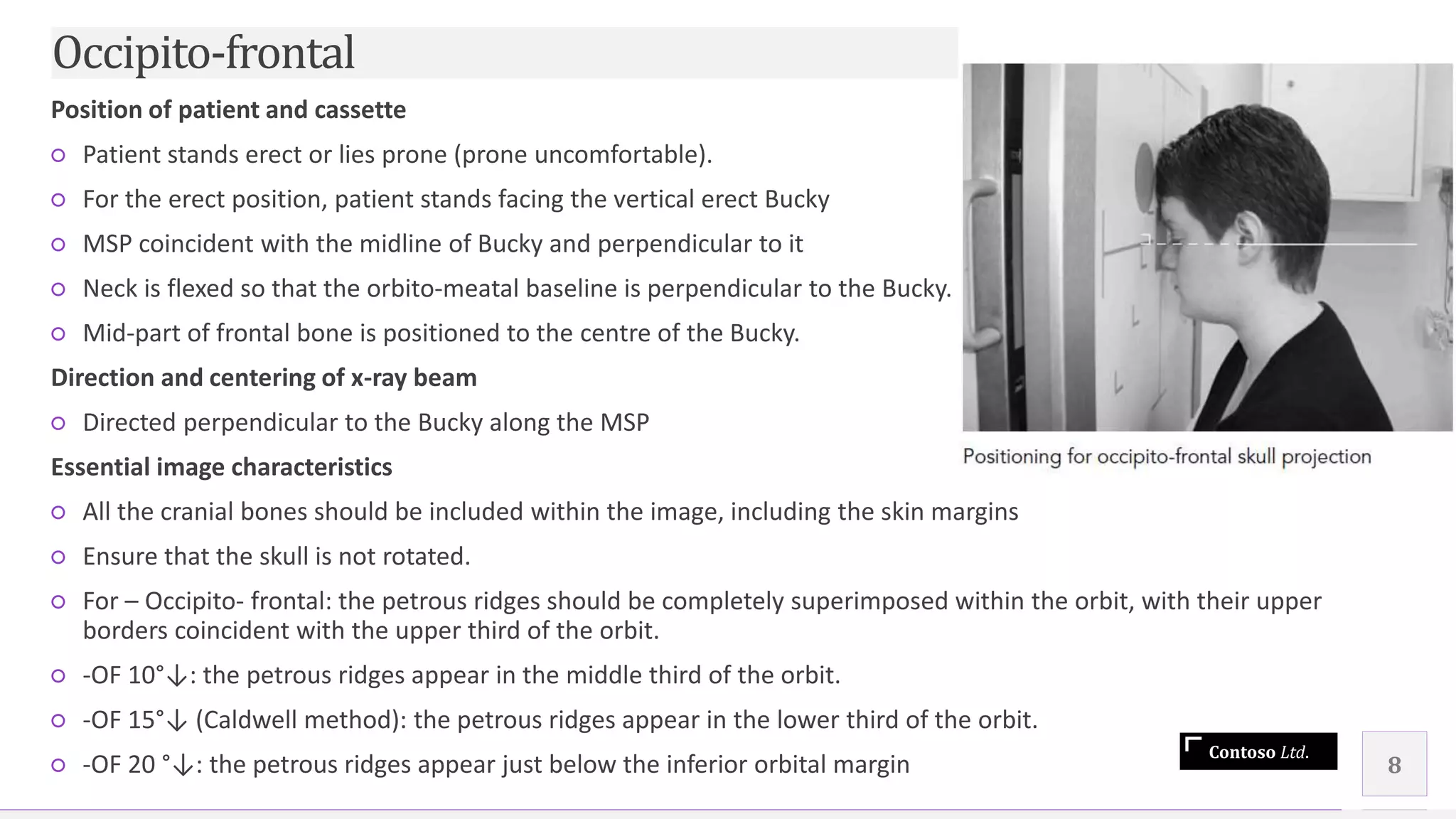 Contoso Ltd.
Position of patient and cassette
○ Patient stands erect or lies prone (prone uncomfortable).
○ For the erect position, patient stands facing the vertical erect Bucky
○ MSP coincident with the midline of Bucky and perpendicular to it
○ Neck is flexed so that the orbito-meatal baseline is perpendicular to the Bucky.
○ Mid-part of frontal bone is positioned to the centre of the Bucky.
Direction and centering of x-ray beam
○ Directed perpendicular to the Bucky along the MSP
Essential image characteristics
○ All the cranial bones should be included within the image, including the skin margins
○ Ensure that the skull is not rotated.
○ For – Occipito- frontal: the petrous ridges should be completely superimposed within the orbit, with their upper
borders coincident with the upper third of the orbit.
○ -OF 10°↓: the petrous ridges appear in the middle third of the orbit.
○ -OF 15°↓ (Caldwell method): the petrous ridges appear in the lower third of the orbit.
○ -OF 20 °↓: the petrous ridges appear just below the inferior orbital margin 8
Occipito-frontal
 
